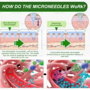CrazyLeaf® SMGT-GLP-1 Nano Microneedle Patch