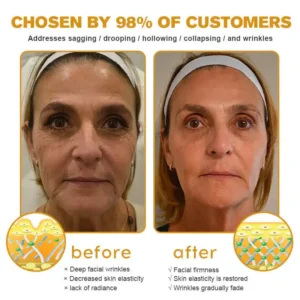 ✅ LOVILDS Bee Venom Wrinkle Removal Cream – LAST DAY 60% OFF