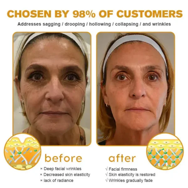 ✅ LOVILDS Bee Venom Wrinkle Removal Cream – LAST DAY 60% OFF