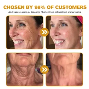 ✅ LOVILDS Bee Venom Wrinkle Removal Cream – LAST DAY 60% OFF