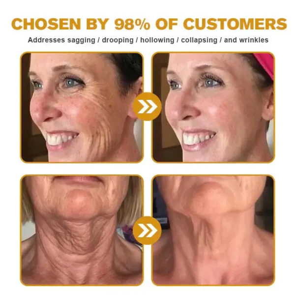 ✅ LOVILDS Bee Venom Wrinkle Removal Cream – LAST DAY 60% OFF