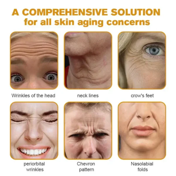✅ LOVILDS Bee Venom Wrinkle Removal Cream – LAST DAY 60% OFF
