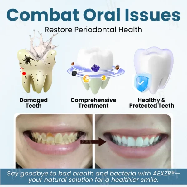 ✅ Recommended by professional dentists🦷 AEXZR® Makesmile Bee Venom Oral Treatment Powder - A one-month supply that eliminates 90% of bacteria that regular brushing can't handle🔥