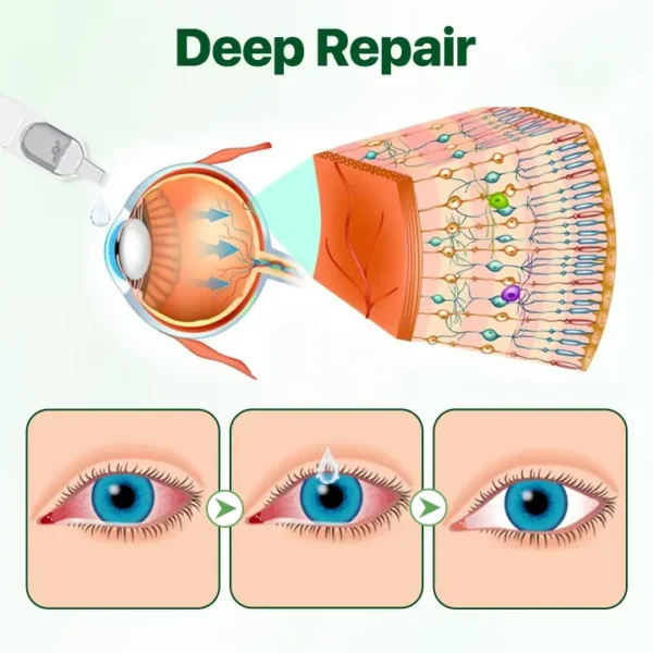 Biancat® Vision Enhancing Multifunctional Eye Drops⭐