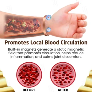 CZTICLE® Arthritis Pain Gone - Magnetic Acupressure Bracelet🦴