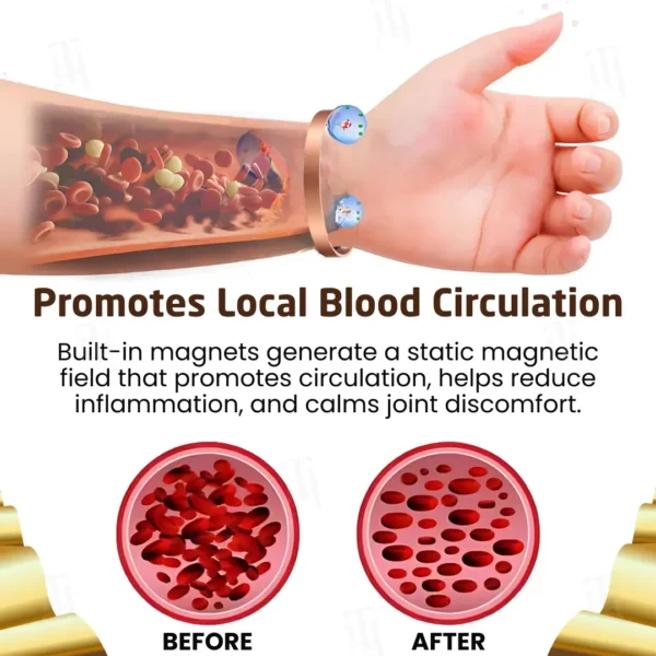 CZTICLE® Arthritis Pain Gone - Magnetic Acupressure Bracelet🦴