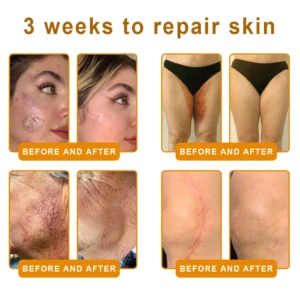 LOVILDS™ Bee Venom Cream – 🌸 Anti-Aging, Hydrating & Skin Repair