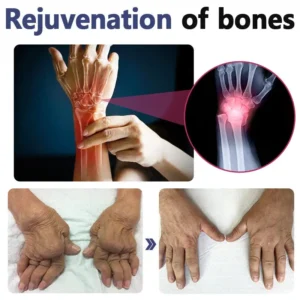 LOVILDS™ Bee Venom Joint and Bone Therapy Advanced Cream🎉Limited Time Offer🐝