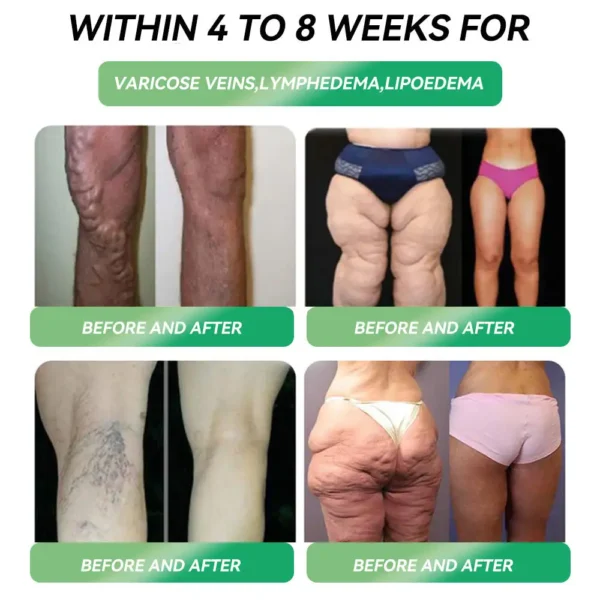 🍃Limited-time offer | 𝐀𝐀𝗙Q®🏅𝐺𝐿𝑃-𝟏 𝑺𝑰𝑿-𝑰𝑵-𝑶𝑵𝑬 𝑯𝒆𝒂𝒍𝒕𝒉 𝑺𝒐𝒍𝒖𝒕𝒊𝒐𝒏 𝑶𝒓𝒂𝒍 𝑳𝒊𝒒𝒖𝒊𝒅 (𝐉𝐮𝐬𝐭 𝐨𝐧𝐜𝐞 𝐚 𝐝𝐚𝐲, 𝐯𝐢𝐬𝐢𝐛𝐥𝐞 𝐜𝐡𝐚𝐧𝐠𝐞𝐬 𝐢𝐧 𝟕 𝐝𝐚𝐲𝐬） ✅ 𝐅𝐨𝐫 𝐨𝐛𝐞𝐬𝐢𝐭𝐲, 𝐜𝐚𝐫𝐝𝐢𝐨𝐯𝐚𝐬𝐜𝐮𝐥𝐚𝐫 𝐡𝐞𝐚𝐥𝐭𝐡, 𝐝𝐢𝐚𝐛𝐞𝐭𝐞𝐬, 𝐬𝐥𝐞𝐞𝐩 𝐚𝐩𝐧𝐞𝐚, 𝐆𝐮𝐭 𝐇𝐞𝐚𝐥𝐭𝐡, 𝐣𝐨𝐢𝐧𝐭 𝐢𝐬𝐬𝐮𝐞𝐬, 𝐚𝐧𝐝 𝐦𝐨𝐫𝐞