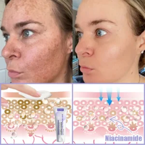 Oveallgo® Anti-Wrinkle Cream To Eliminate Wrinkles, Firm And Whiten The Skin - Last offer! 🔥90% discount