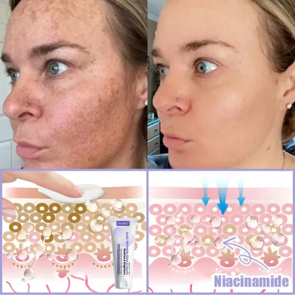 Oveallgo® Anti-Wrinkle Cream To Eliminate Wrinkles, Firm And Whiten The Skin - Last offer! 🔥90% discount