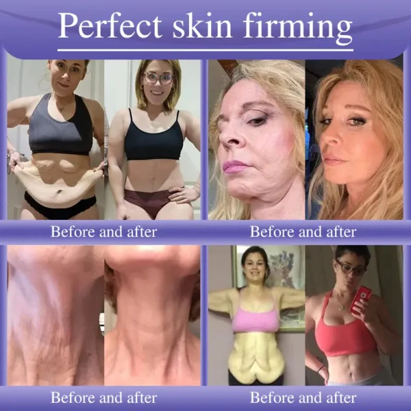 Oveallgo® Anti-Wrinkle Cream To Eliminate Wrinkles, Firm And Whiten The Skin - Last offer! 🔥90% discount
