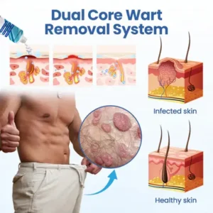 Oveallgo® GentX PRO WartRelief Cream