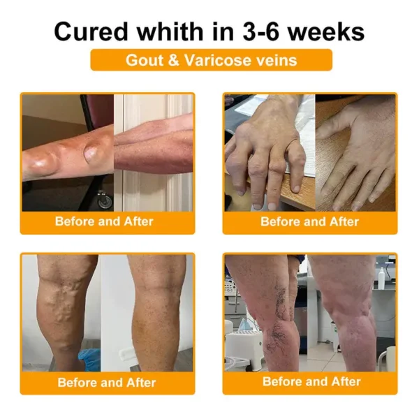 RAINDEW® BEE VENOM LITHOSPERMUM Pain-Relief Bone Healing Cream 👑👑(Specially for older adults)