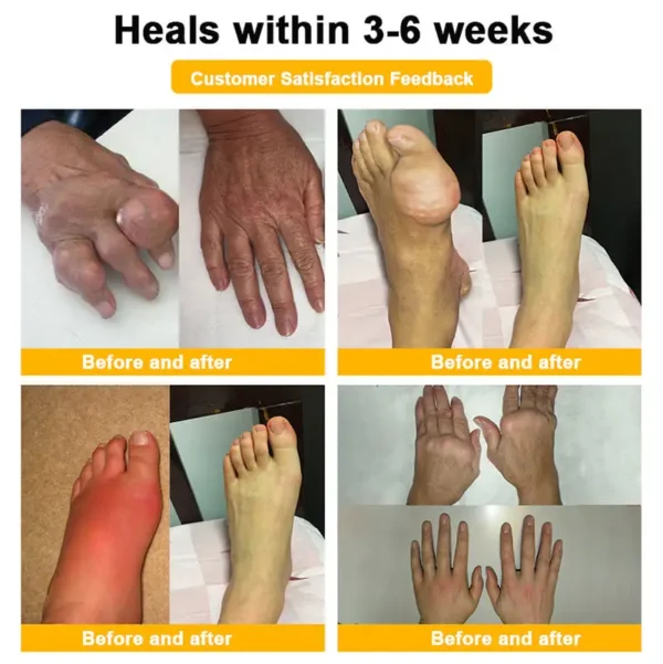 RAINDEW® BEE VENOM LITHOSPERMUM Pain-Relief Bone Healing Cream 👑👑(Specially for older adults)