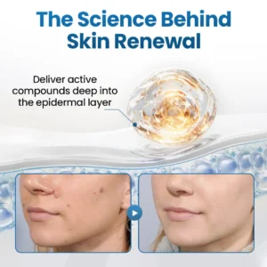 Biancat® BumpFlatten Cream🇬🇧 XH-BumpFlatten-UPSELL