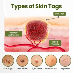 Biancat® MagneErase Renewal Cream