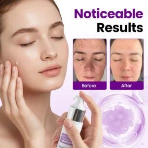 Biancat® SpotErase Probiotic Shield Serum 🇬🇧 XH-SpotErase-upsell