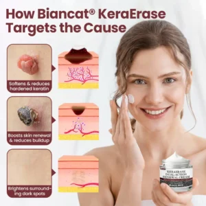 Biancat®KeraErase Dual-Action Renewal Cream (A)