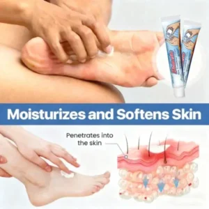 LOVILDS™ Diabetic  Skin Treatment Cream