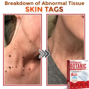 LOVILDS™   Removal Patch