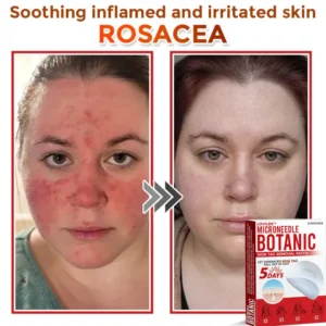 LOVILDS™   Removal Patch