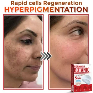 LOVILDS™   Removal Patch