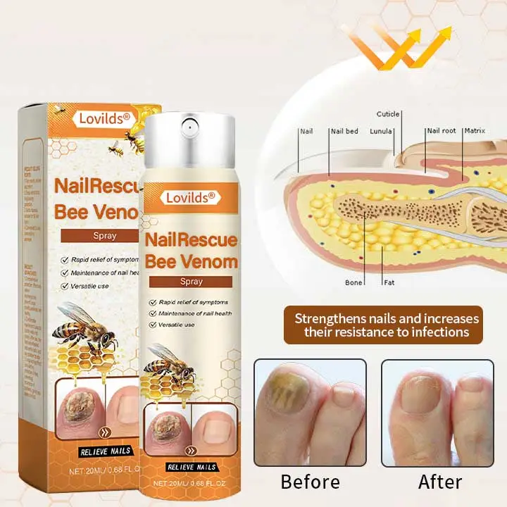 【Oficiální vlajkový obchod】Lovilds® NailRescue Včelí jed ve spreji✅✅