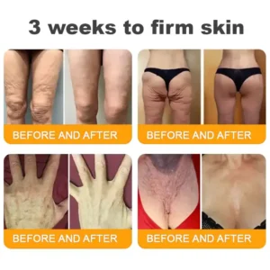 𝐋𝐎𝐕𝐈𝐋𝐃𝐒™ 𝐁𝐞𝐞 𝐕𝐞𝐧𝐨𝐦 𝐀𝐥𝐥-𝐢𝐧-𝐎𝐧𝐞 𝐂𝐫𝐞𝐚𝐦–🌸 Anti-aging,Hydrating, Skin Repair, Even Tone, Acne and Dark Spot Treatment, Wart and Mole Removal, Psoriasis Relief