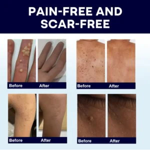 🖤🔥𝘽𝙡𝙖𝙘𝙠 𝙁𝙧𝙞𝙙𝙖𝙮 𝙨𝙖𝙡𝙚 | AAFQ® WartLock CRYO RECOVERY SPRAY