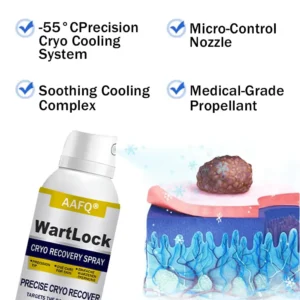 🖤🔥𝘽𝙡𝙖𝙘𝙠 𝙁𝙧𝙞𝙙𝙖𝙮 𝙨𝙖𝙡𝙚 | AAFQ® WartLock CRYO RECOVERY SPRAY