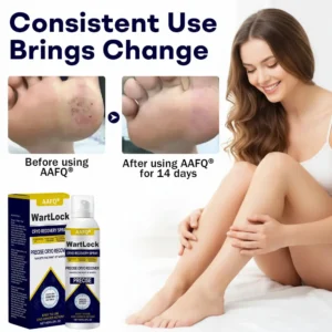 🖤🔥𝘽𝙡𝙖𝙘𝙠 𝙁𝙧𝙞𝙙𝙖𝙮 𝙨𝙖𝙡𝙚 | AAFQ® WartLock CRYO RECOVERY SPRAY