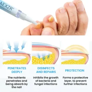 🏷️ EXCLUSIVE DEAL! 50% OFF - AEXZR® NanoFix Nail Repair Pen