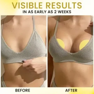 AEXZR® Apex-Lift Volumizing & Lifting Microneedle Bust Patch