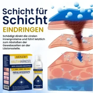 AEXZR® Hautanhängsel-Kryo-Behandlungsspray