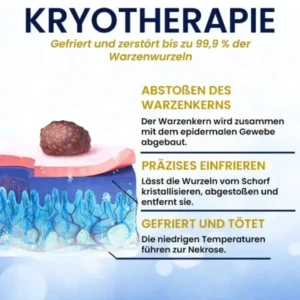 AEXZR® Hautanhängsel-Kryo-Behandlungsspray
