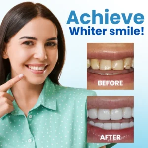 AEXZR® Postbiotics Anti-Plaque Oral Serum