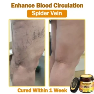 LOVILDS™ 𝐁𝐞𝐞 Poison 𝐀𝐥𝐥-𝐢𝐧-𝐎𝐧𝐞 𝐂𝐫𝐞𝐚𝐦