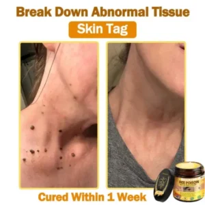 LOVILDS™ 𝐁𝐞𝐞 Poison 𝐀𝐥𝐥-𝐢𝐧-𝐎𝐧𝐞 𝐂𝐫𝐞𝐚𝐦