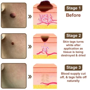 LOVILDS® Black Rice Soothing Repair Cream ⚕️