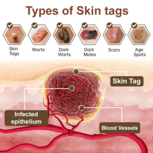 LOVILDS® Black Rice Soothing Repair Cream ⚕️