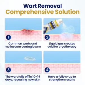 LOVILDS™ ChillErase Bump Renewal Spray🔥