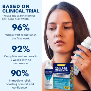 LOVILDS®  Cryo Treatment Spray Effortlessly remove skin tags and warts-no pain