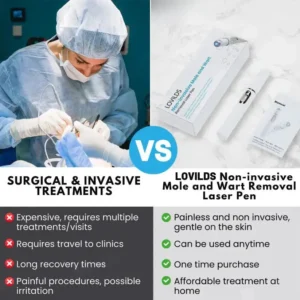 🔥【OFFICIAL STORE】LOVILDS™ Non-Invasive Mole and Wart Removal Laser Pen