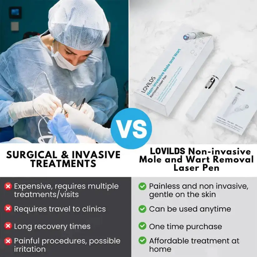 🔥【OFFICIAL STORE】LOVILDS™ Non-Invasive Mole and Wart Removal Laser Pen