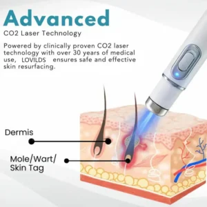 🔥【OFFICIAL STORE】LOVILDS™ Non-Invasive Mole and Wart Removal Laser Pen