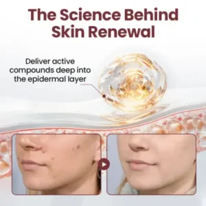 Thonesr® KeraErase Dual-Action Renewal Cream