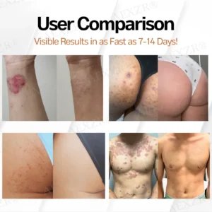 ⚡ New Year Flash Deals! 50% OFF - AEXZR® New Zealand Manuka Honey All-in-One Cream