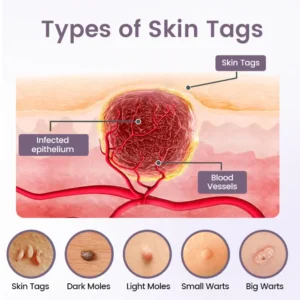 Cougex® WartSmooth Renewal Serum