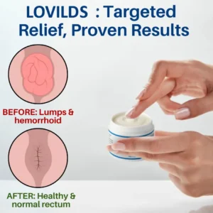 🔥LAST DAY SALE-60% OFF🔥 - LOVILDS® Hemorrhoid & Fissure Cream